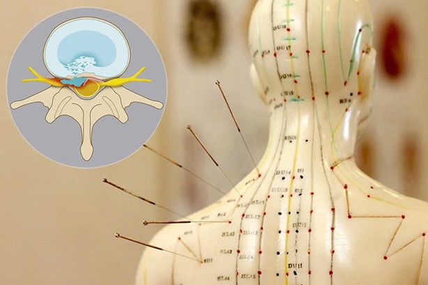 Điều Trị Tiểu Đường